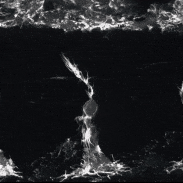 Nerves regenerating on a zebrafish.